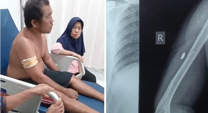 Nelayan di Asahan Diduga Jadi Korban Tembakan Peluru Nyasar saat Melaut